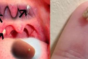 咳嗽，有時候咳出一顆白白的東西是什麼？味道很臭？