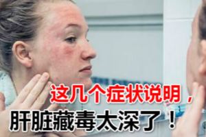 這幾個症狀說明，肝髒藏毒太深了！肝髒很受傷，排毒「功力」下降，導致肝髒「有毒」。