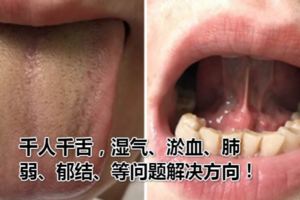 千人千舌，濕氣、淤血、肺弱、郁結、陰陽虛等問題解決方向！