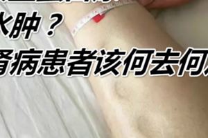 大量蛋白尿？水腫？腎病患者該何去何從