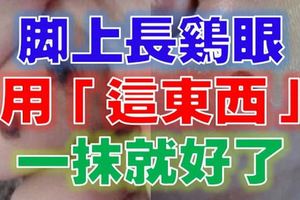 腳上長雞眼，用「這東西」只要一抹就好，超神奇！好方法一定要分享出去！！