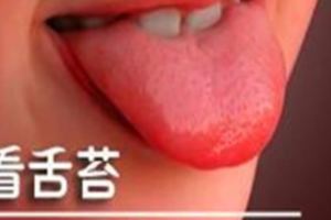 有無糖尿病？糖尿病到了哪個階段？看舌頭就知道了