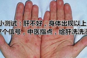 小測試：肝不好，身體出現以上7個信號，中醫指點，給肝洗洗澡！