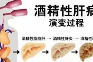 肝不好，百病生！專家教您巧用「三味」中藥，對症養肝！