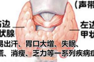 甲亢患者到底能吃什麼？看了真心······