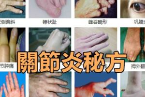 關節炎秘方