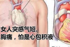 女人突感氣短、胸痛，怕是心包積液，需多吃這類食物