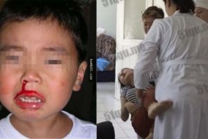 2歲男孩「流鼻血昏倒」送醫後竟然直接死亡，當醫生告訴媽媽是個原因時…她整個後悔到發狂啊！
