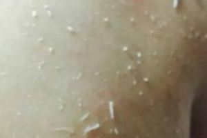 搓澡挫下來的白條是什麼？