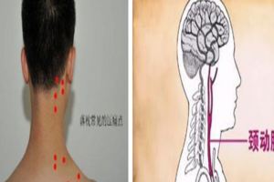 頸椎病不能隨便亂按，亂按反而更加嚴重，在家治好頸椎病，趕緊試