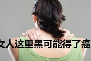 女人這裡黑可能得了癌症