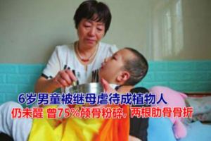 6歲男童被繼母虐待成植物人仍未醒曾75%顱骨粉碎