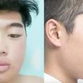 韓國男生也愛上了整形「甚至要比女生更美」，揭秘雙眼皮尖下巴的整形過程讓外國人超震撼啊！