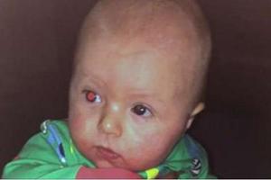  媽媽用網絡上教的「開閃光燈拍照片」發現兒子真的有眼癌，但上帝隨後就為全家帶來大驚喜！